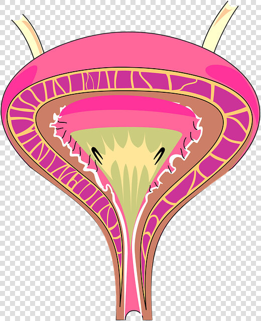 Interstitial Cystitis Clipart  HD Png DownloadTransparent PNG