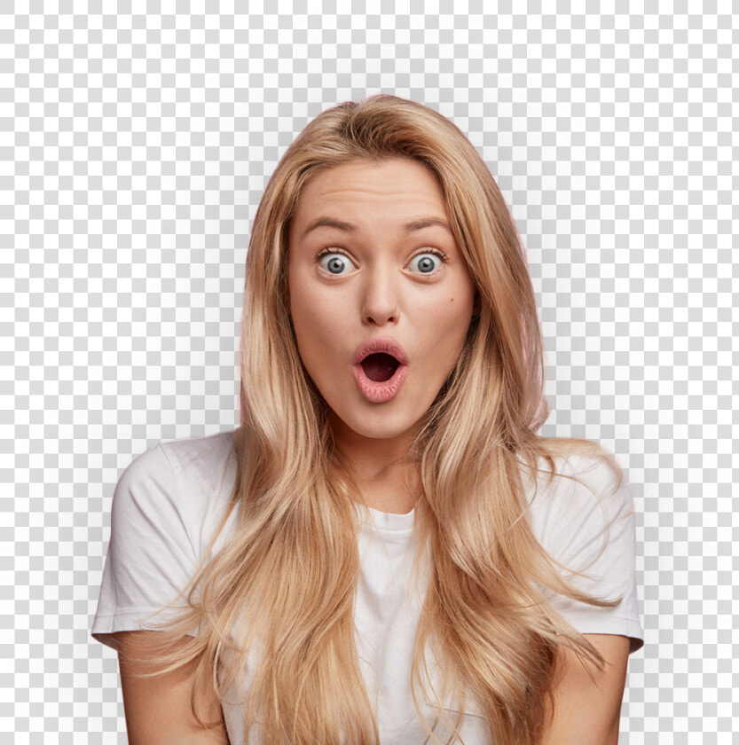 Transparent Surprised Girl Png   Ectodermal Dysplasia Abnormal Hair  Png DownloadTransparent PNG