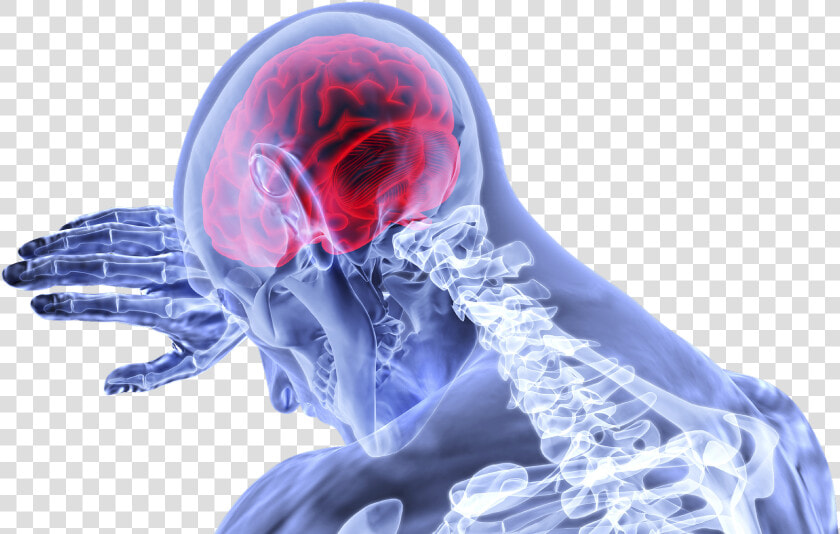 Traumatic Brain Injury Png  Transparent PngTransparent PNG