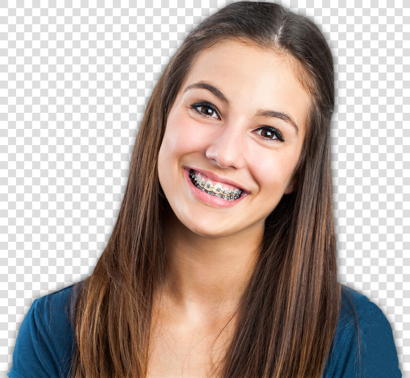 Thumb Image   Braces Smile  HD Png DownloadTransparent PNG