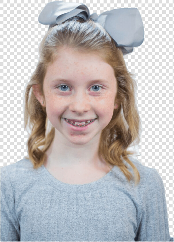 Child Lawless Orthodontics Patient   Child  HD Png DownloadTransparent PNG