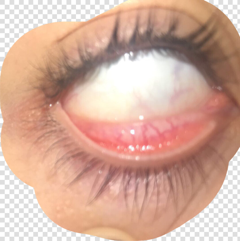  eye  veins  goth  freetoedit   Close up  HD Png DownloadTransparent PNG