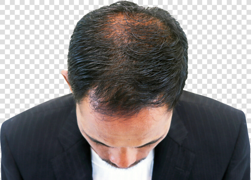 Hair Growth Dr Batra Review  HD Png DownloadTransparent PNG