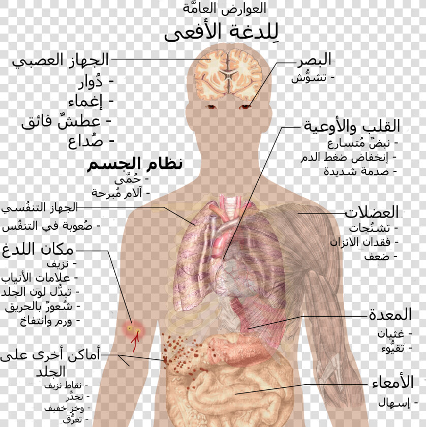 Snake Bite Symptoms ar   Snake Bite Symptoms  HD Png DownloadTransparent PNG