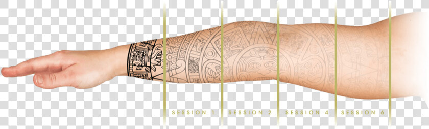 Tri Beam Tattoo Removal Results  HD Png DownloadTransparent PNG