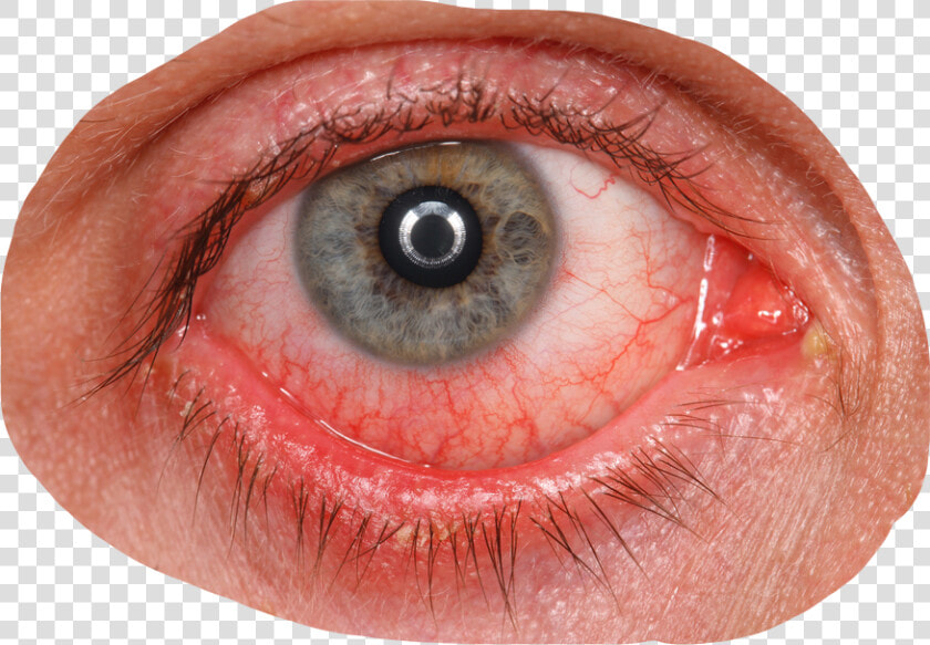 Bloodshot Eyes Png  Transparent PngTransparent PNG