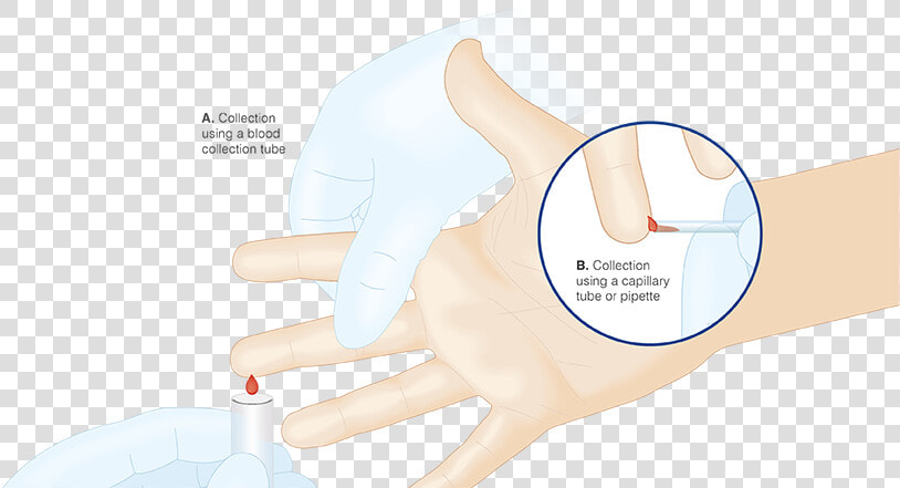 Collecting A Finger Capillary Blood Sample Via Blood   Blood Collection Procedures Adult Hand  HD Png DownloadTransparent PNG