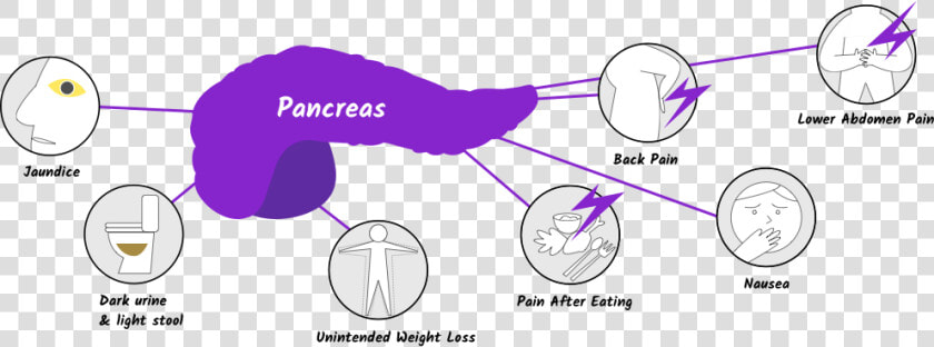 Pancreatic Cancer Symptoms  HD Png DownloadTransparent PNG