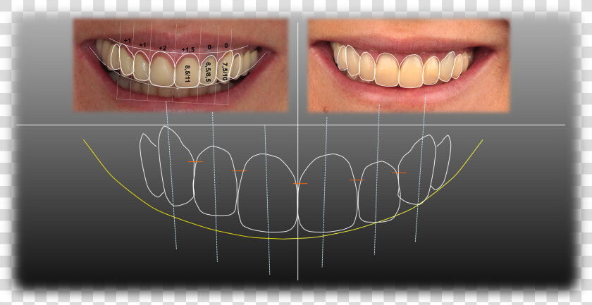 Diseño Digital De Sonrisa  HD Png DownloadTransparent PNG