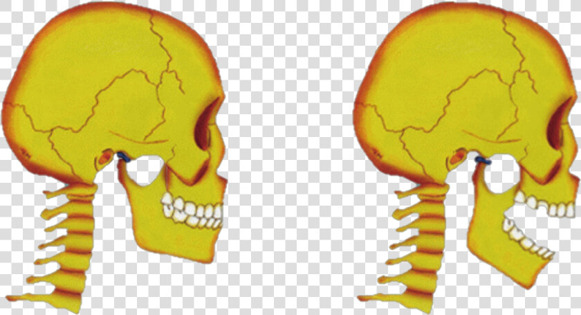 Tmj Disorders Jaw Joint Pain   Skull  HD Png DownloadTransparent PNG