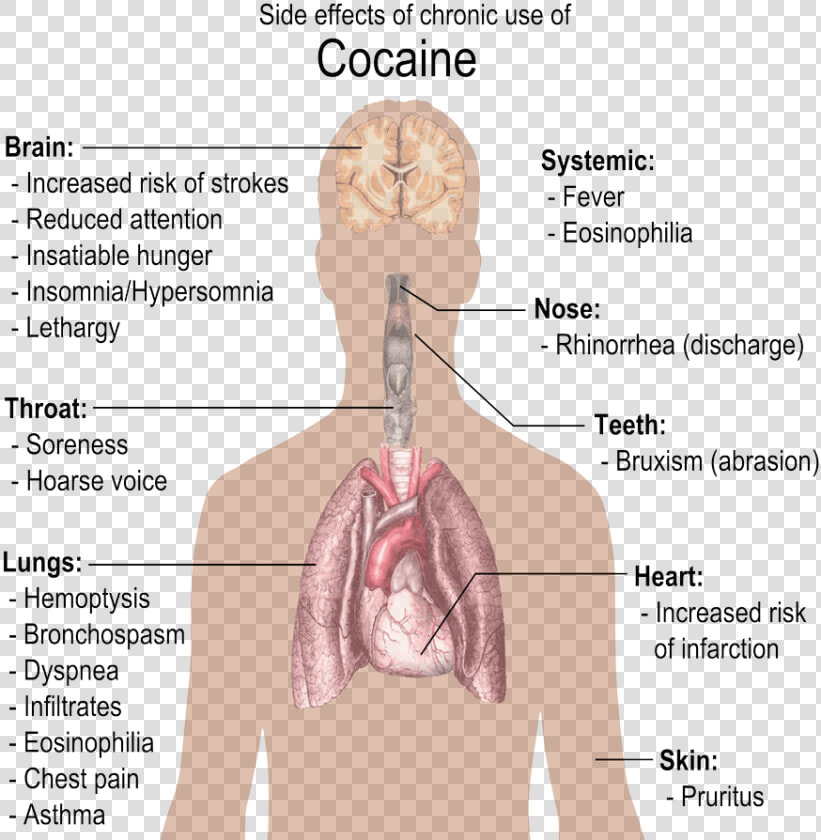 Using Clinical Hypnotherapy To Combat Narcotic And   Do Drugs Affect The Body  HD Png DownloadTransparent PNG