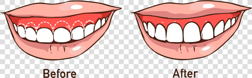 Advanced Dental Care   Straight Line Teeth  HD Png DownloadTransparent PNG