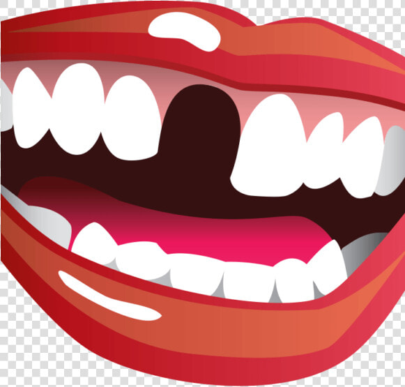 Transparent Brush Teeth Clipart   Missing Teeth Clipart  HD Png DownloadTransparent PNG