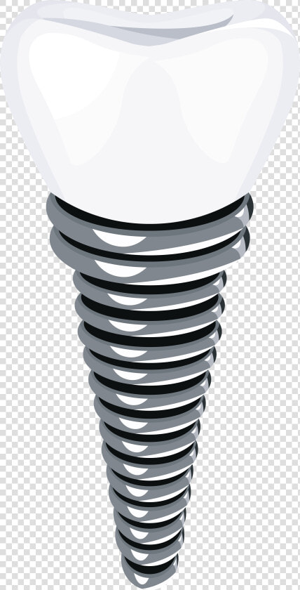 Dental Implant Png Clip Art   Transparent Implant  Png DownloadTransparent PNG