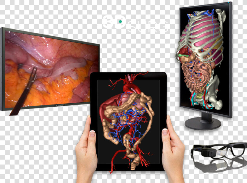 3d Technology Applied To Surgery   Graphic Design  HD Png DownloadTransparent PNG