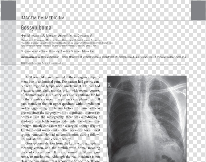 Medical Radiography  HD Png DownloadTransparent PNG