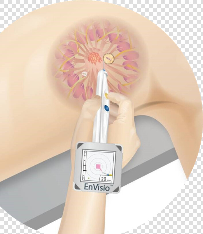 An Illustration Showing How The Elucent Device Pinpoints   Floral Design  HD Png DownloadTransparent PNG