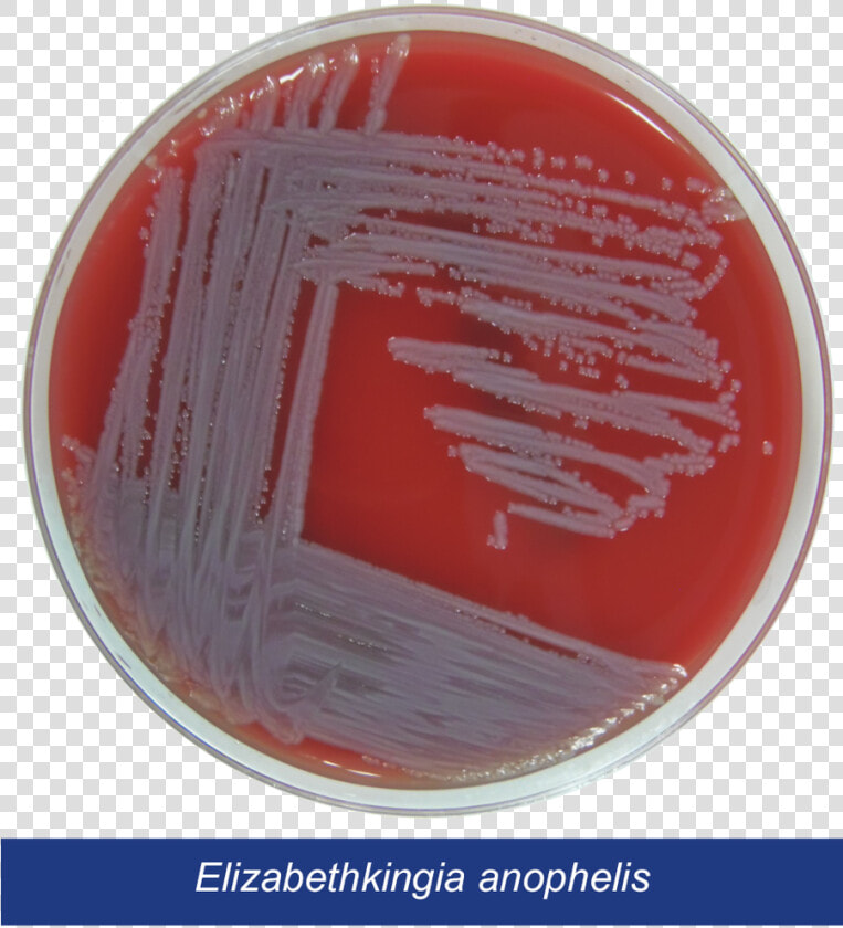 Petri Dish Png  Transparent PngTransparent PNG