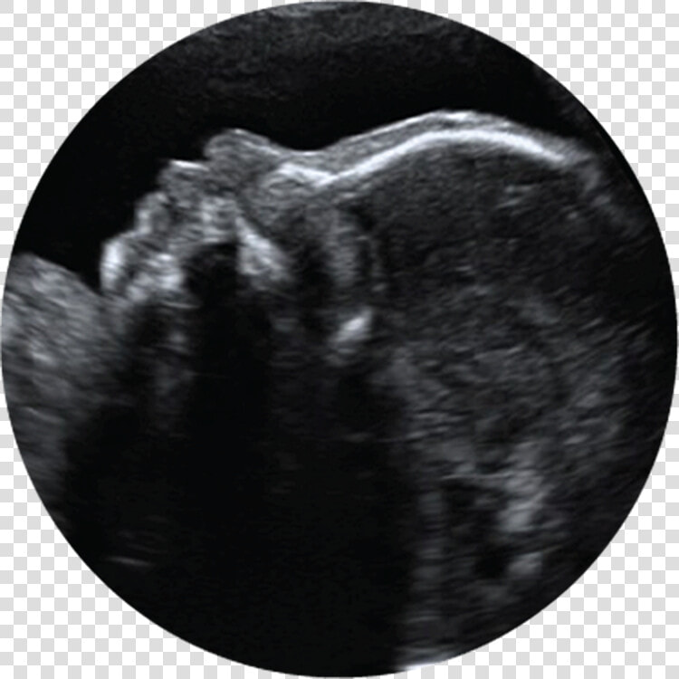 Prenatal Ultrasound Clipart  HD Png DownloadTransparent PNG