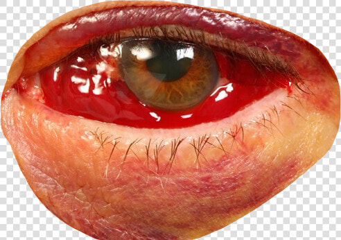  eye  bloodshot  blood  redeye  bloodshoteyes  face freetoedit   Transparent Blood Shot Eyes  HD Png DownloadTransparent PNG