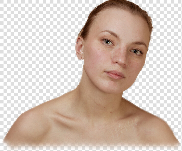 Transparent Realistic Scar Png   Barechested  Png DownloadTransparent PNG