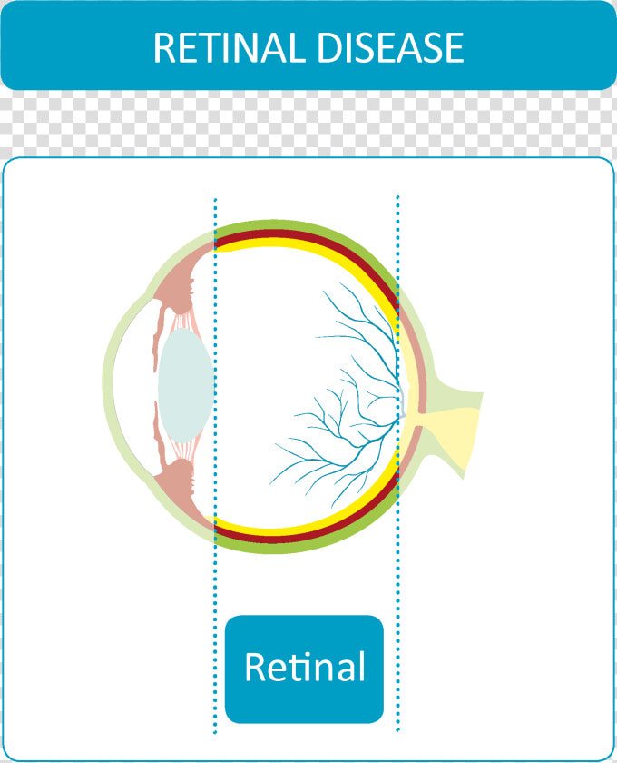 Retinal Diseases   Circle  HD Png DownloadTransparent PNG