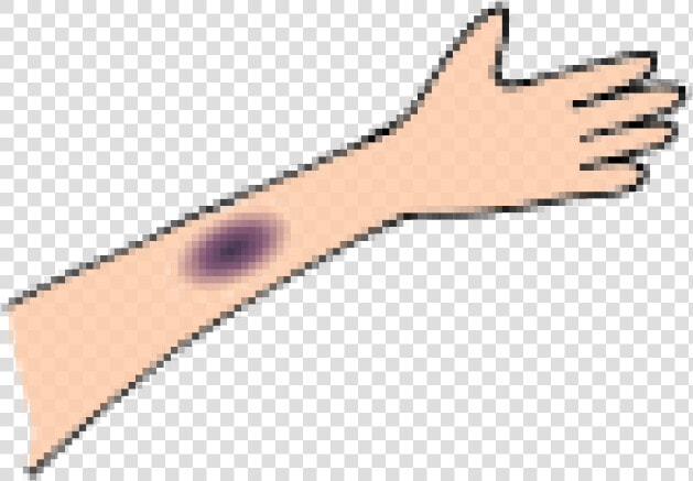 Bruises Cliparts   Marking Tools  HD Png DownloadTransparent PNG