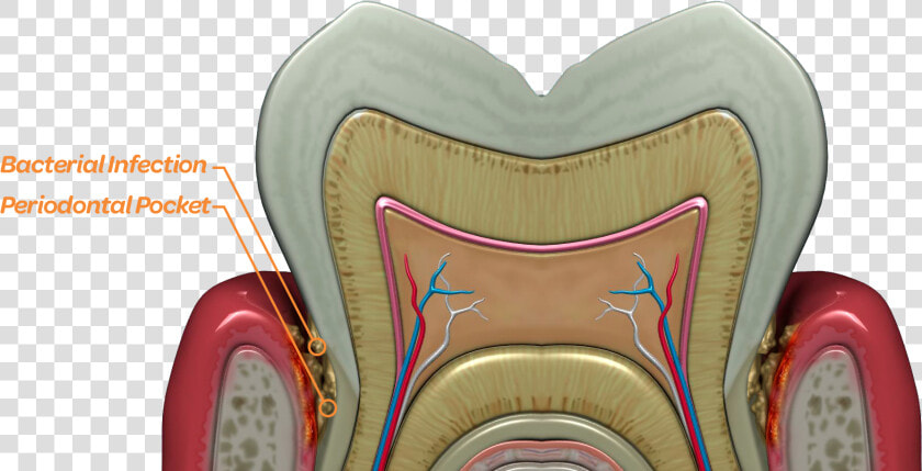 Bacteria Thrive Deep Below The Gum Line In The Periodontal   Tooth  HD Png DownloadTransparent PNG