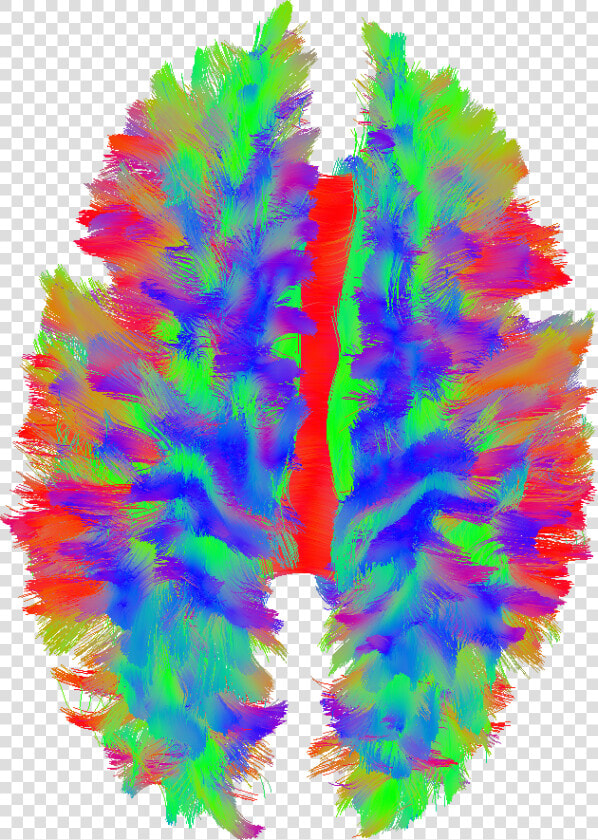 This Picture Illustrates The Nerve Fibers Of The Brain  HD Png DownloadTransparent PNG