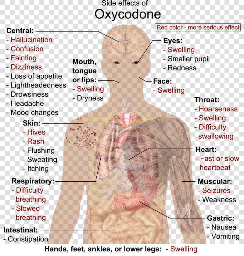 Side Effects Of Oxycodone   Oxycodone Side Effects  HD Png DownloadTransparent PNG