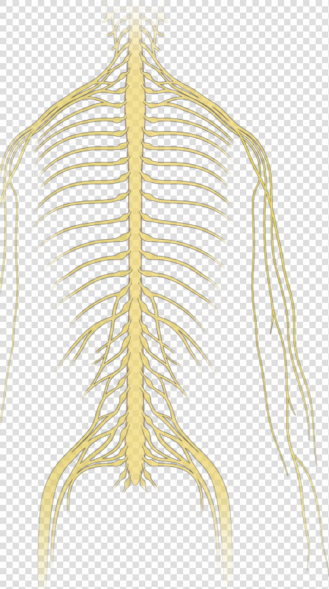 Neoplastic Epidural Spinal Cord Compression Nejm   Drawing  HD Png DownloadTransparent PNG