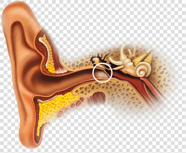 Calcification Of Ear Canal  HD Png DownloadTransparent PNG