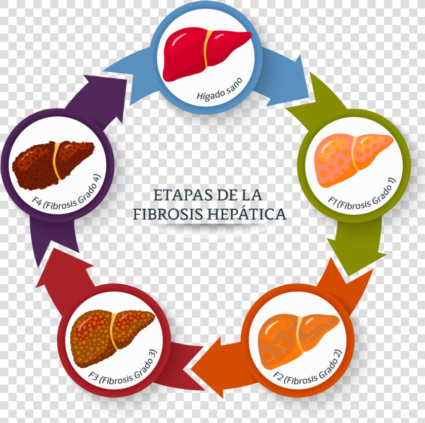 Guía De Interpretación De Fibrosis Hepática   Theory Of Constraints  HD Png DownloadTransparent PNG