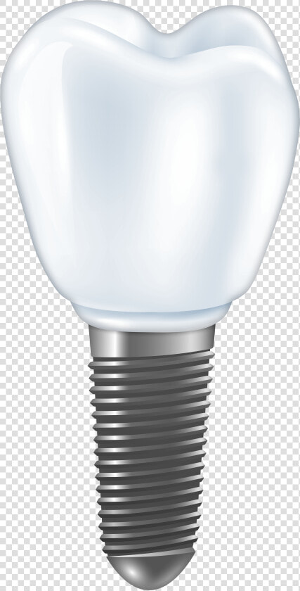 Dental Implant Png Clipart   Compact Fluorescent Lamp  Transparent PngTransparent PNG