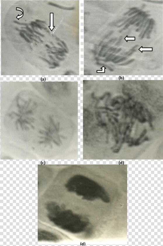 Abnormal Anaphase Cells Showing   Medical Imaging  HD Png DownloadTransparent PNG