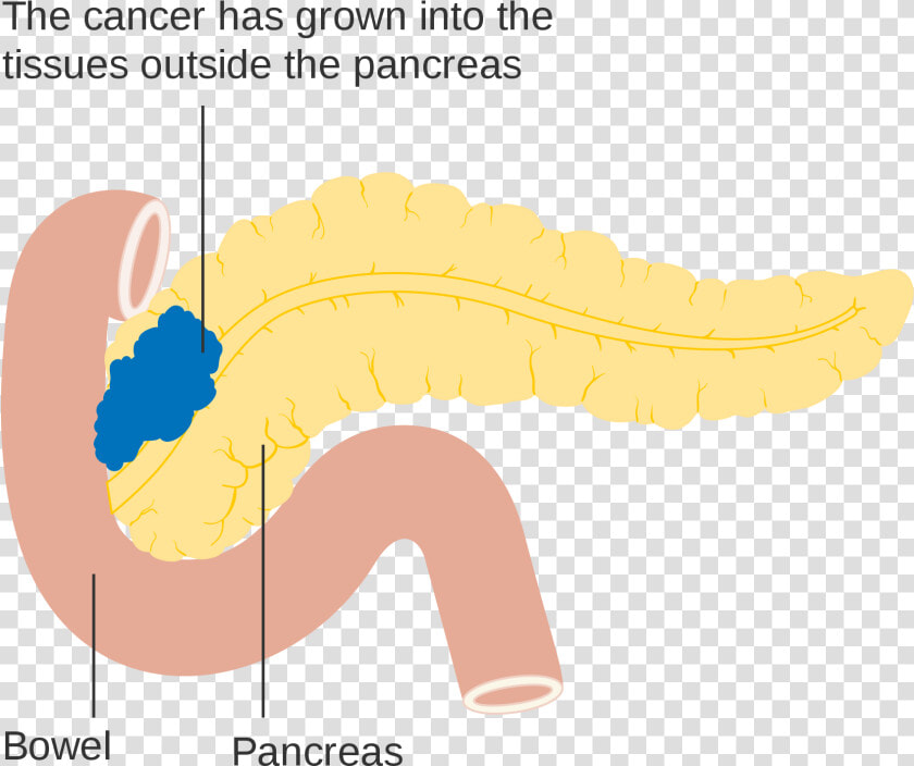 Pancreas Diagram Png   Png Download   Illustration  Transparent PngTransparent PNG