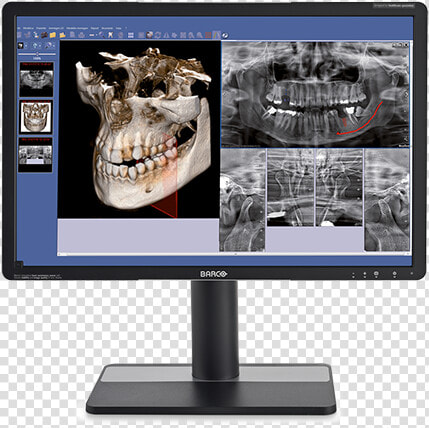 Go 2de3d Nnt Go   Computer Monitor  HD Png DownloadTransparent PNG