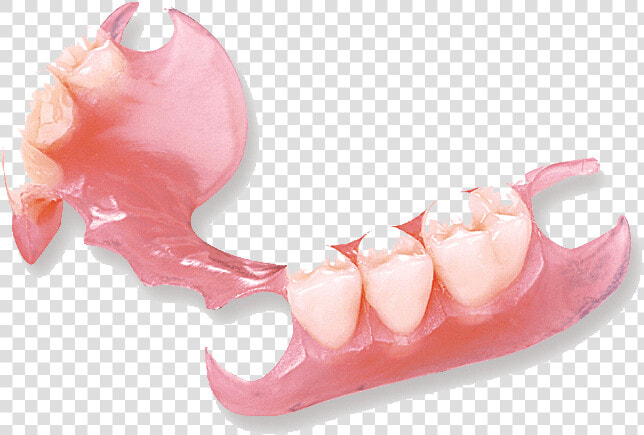 Flexi Partial Denture  HD Png DownloadTransparent PNG