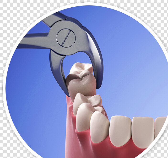 Horizon Microscope Enhanced Dentistry   Tooth Extraction Data  HD Png DownloadTransparent PNG