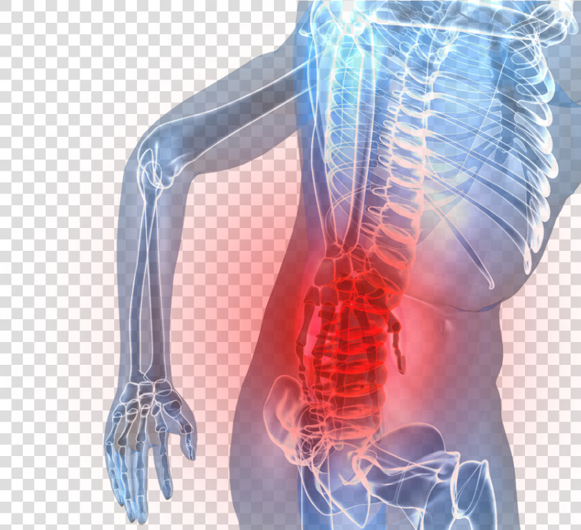 Transparent Spinal Cord Png   Low Back Pain Png  Png DownloadTransparent PNG