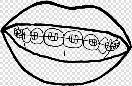  brackets  sonrisa  dibujo  blancoynegro   Sketch  HD Png DownloadTransparent PNG