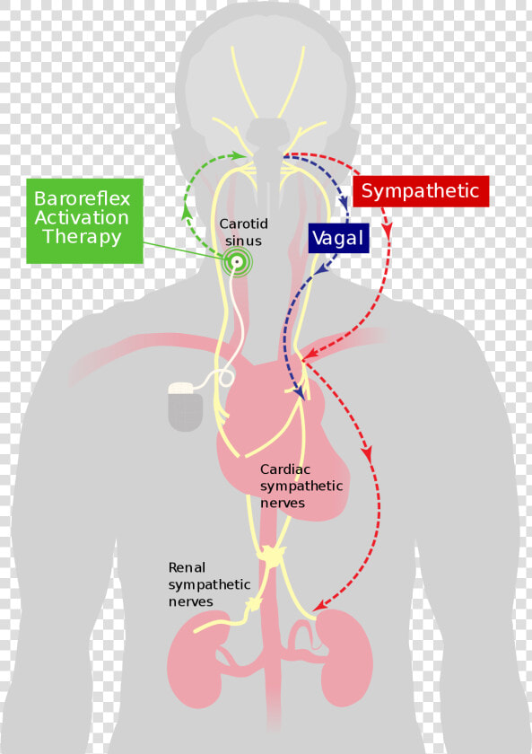 Carotid Baroreceptor  HD Png DownloadTransparent PNG