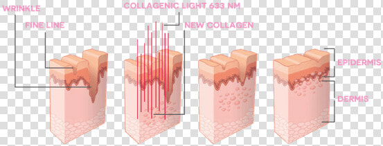 Dr Muller Collagenic Light   Red Light Therapy Before  HD Png DownloadTransparent PNG