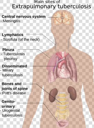 Extrapulmonary Tuberculosis Symptoms   Symptoms Of Tuberculosis  HD Png Download