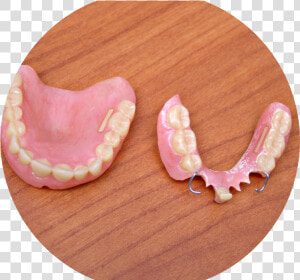 Dentures   Részleges Protézis  HD Png Download