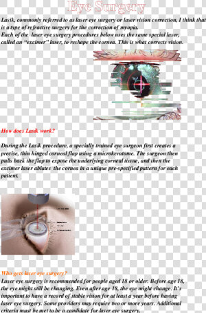 Laser Eye Surgery  HD Png Download