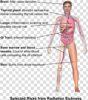 Radiation Poisoning Symptoms  HD Png Download