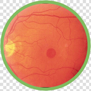 Macular Hole   狂犬病 予防 接種 シール  HD Png Download