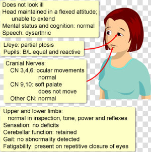 Ocular Myasthenia Gravis History  HD Png Download