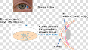 Diagram On Repairing The Cornea   Holoclar Stem Cell  HD Png Download